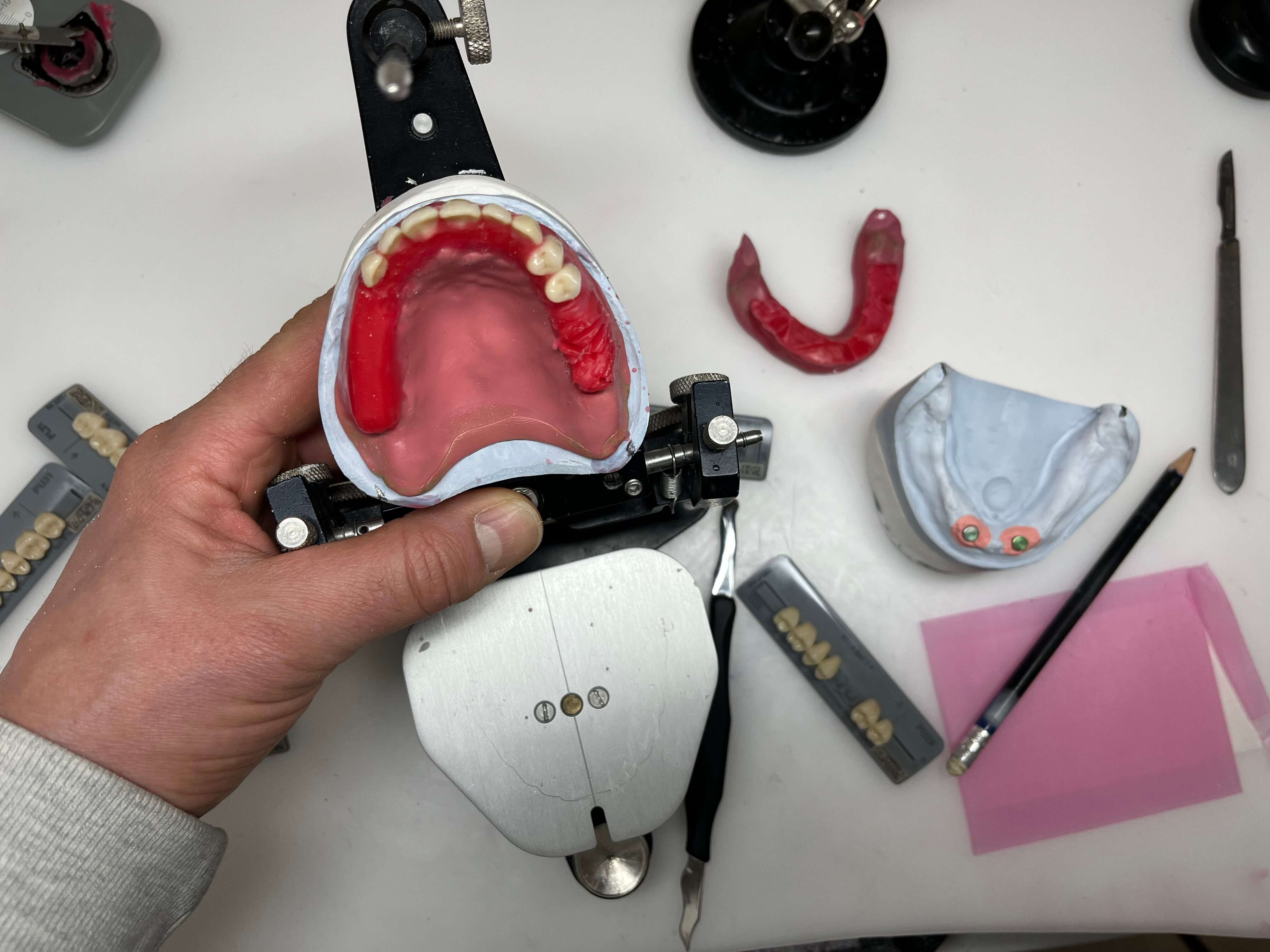 Tandtechniek Uitgeest prothese